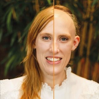 Expositie “Wat maakt haar een vrouw” over Alopecia