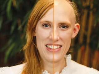 Expositie “Wat maakt haar een vrouw” over Alopecia